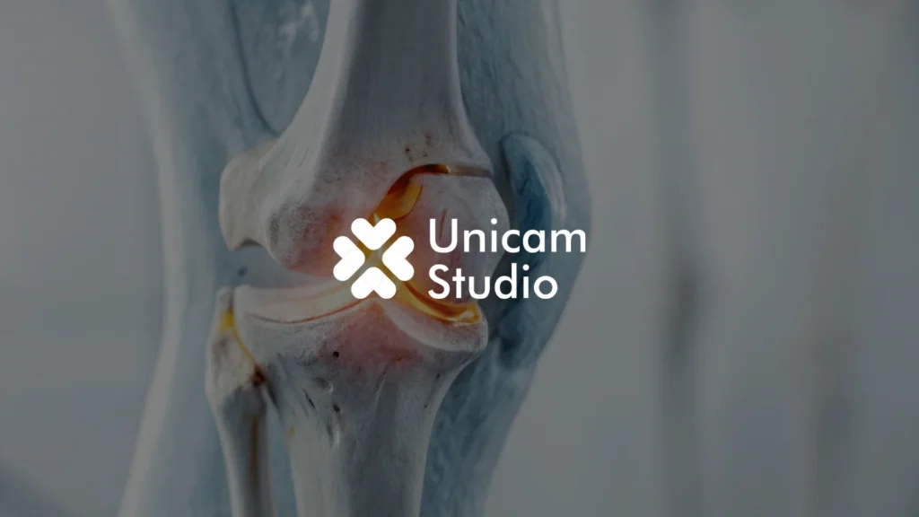 Tingkatkan pemahaman medis dengan Animasi 3D Trauma Ortopedi dari Unicam Studio. Visualisasi presisi untuk edukasi, dan kampanye kesehatan.