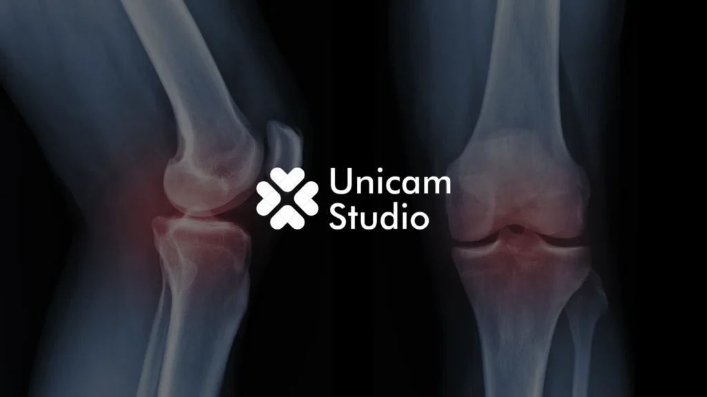 Tingkatkan edukasi medis dengan Animasi 3D Trauma Ortopedi Bali dari Unicam Studio. Visualisasi presisi untuk video TVC, dan iklan kesehatan.