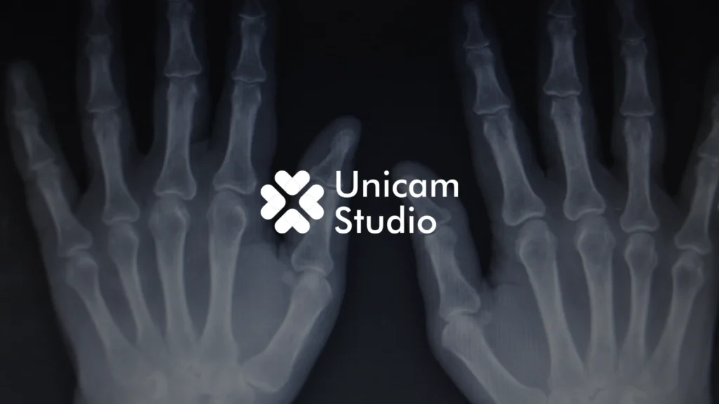 Tingkatkan edukasi dengan Animasi 3D Trauma Ortopedi Bekasi dari Unicam Studio. Visualisasi presisi untuk video TVC, dan kampanye kesehatan.