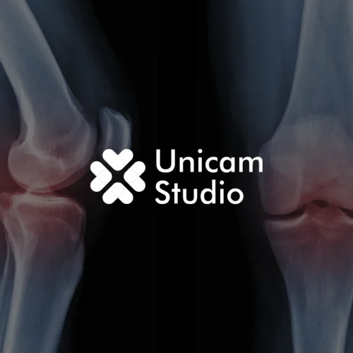Tingkatkan kualitas edukasi dengan Animasi 3D Trauma Ortopedi Bogor dari Unicam Studio. Visualisasi presisi untuk video TVC, dan kampanye.