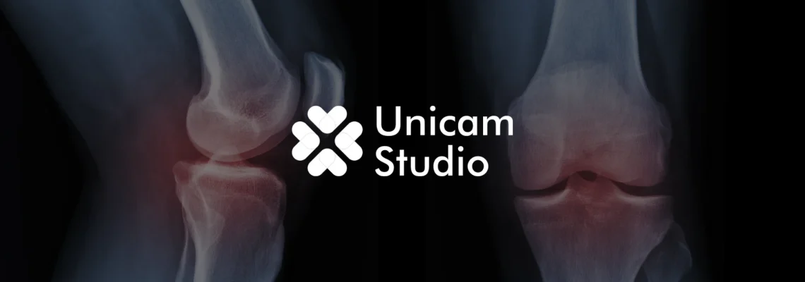 Tingkatkan kualitas edukasi dengan Animasi 3D Trauma Ortopedi Bogor dari Unicam Studio. Visualisasi presisi untuk video TVC, dan kampanye.