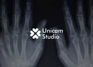 Tingkatkan edukasi dengan Animasi 3D Trauma Ortopedi Karawang dari Unicam Studio. Visualisasi presisi untuk video TVC, dan iklan industri.