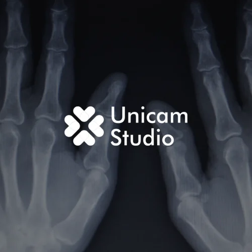 Tingkatkan edukasi dengan Animasi 3D Trauma Ortopedi Karawang dari Unicam Studio. Visualisasi presisi untuk video TVC, dan iklan industri.